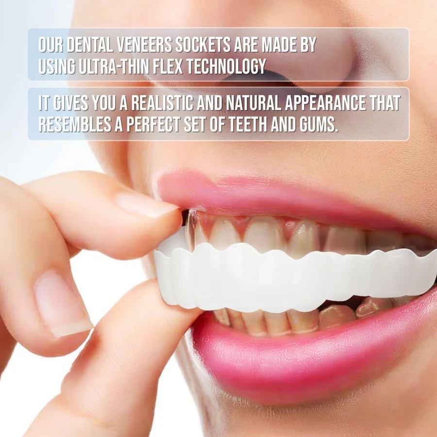 Smile Enhancer | Full Dental Veneer Kit with Adjustable Fit | Natural Look for Instant Confidence