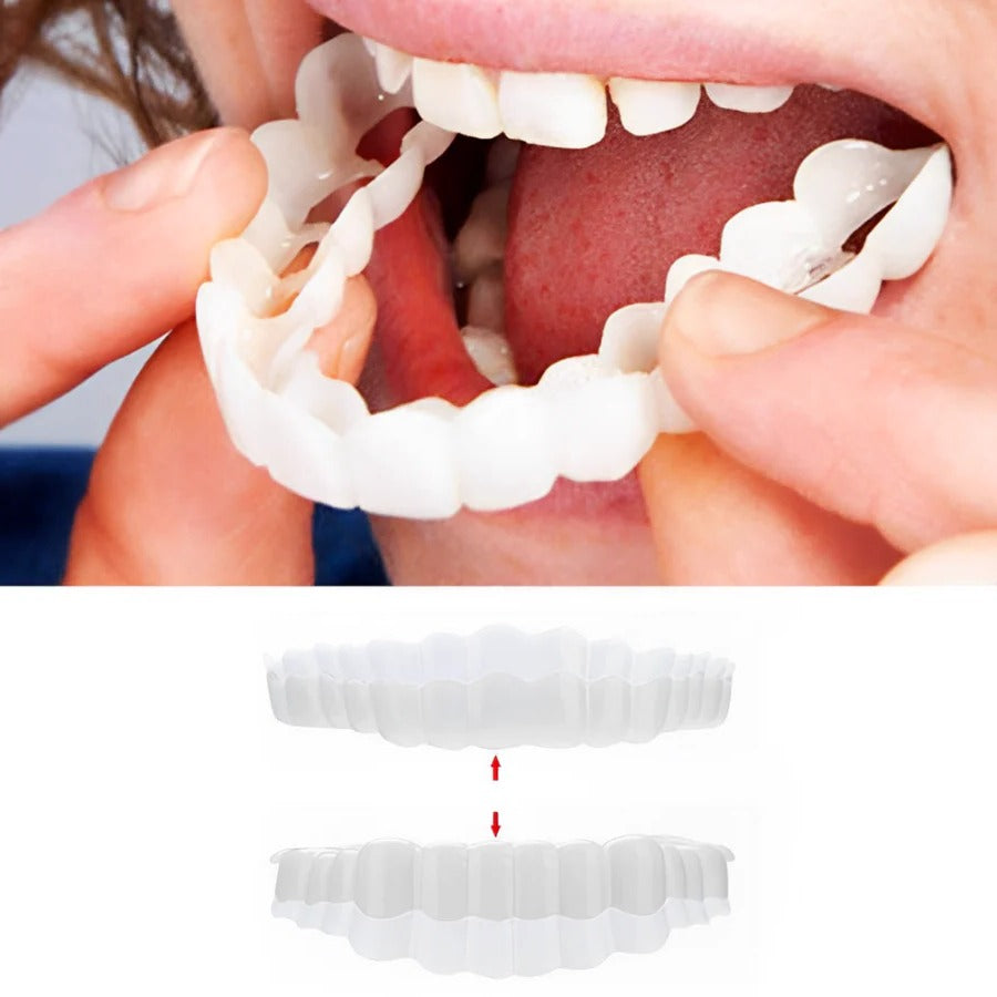 Smile Enhancer | Full Dental Veneer Kit with Adjustable Fit | Natural Look for Instant Confidence
