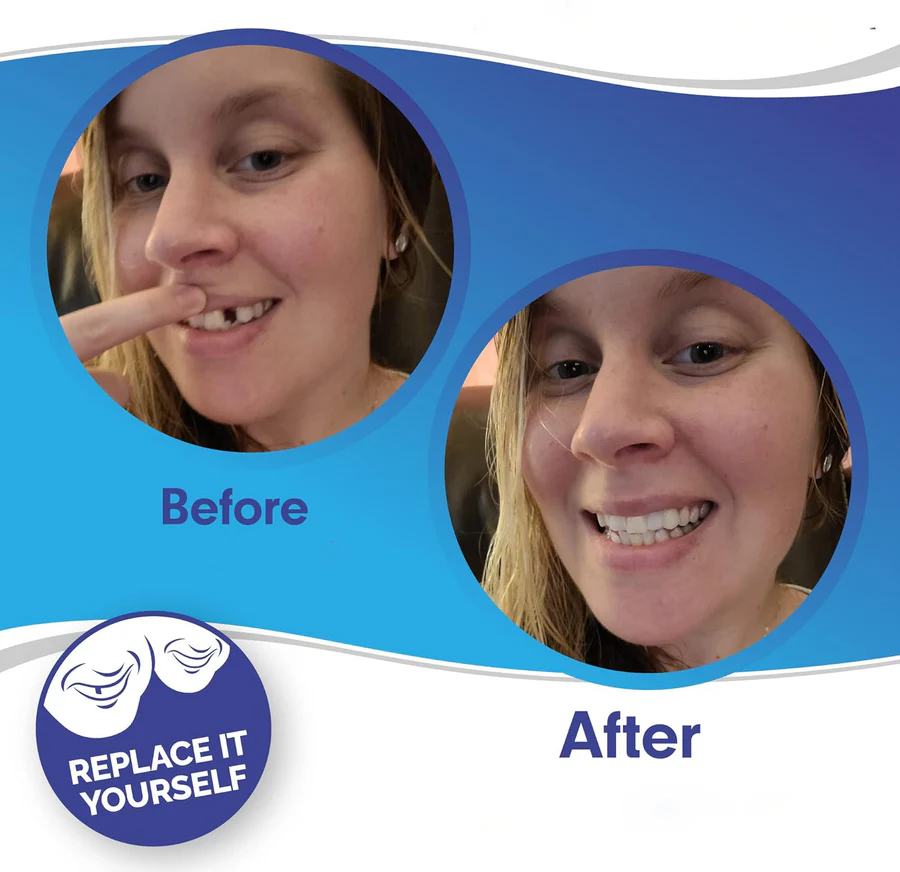 Smile Enhancer | Full Dental Veneer Kit with Adjustable Fit | Natural Look for Instant Confidence