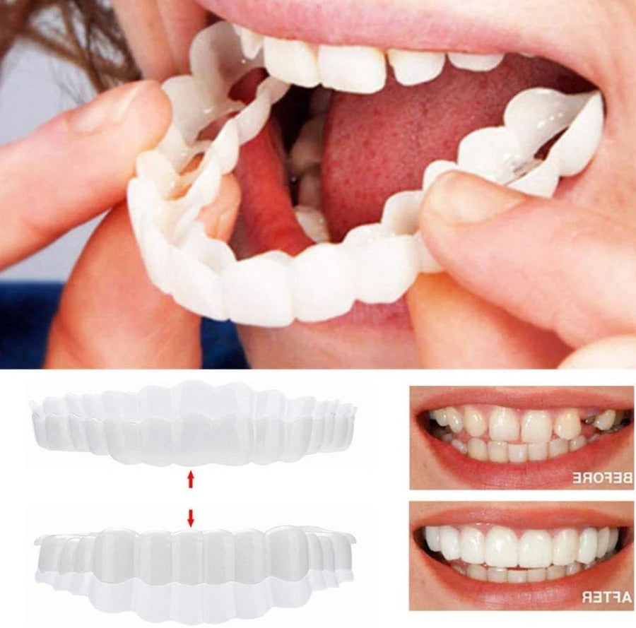 Smile Enhancer | Full Dental Veneer Kit with Adjustable Fit | Natural Look for Instant Confidence